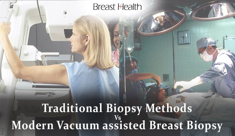 Traditional Biopsy Methods Vs Modern Vacuum assisted Breast Biopsy