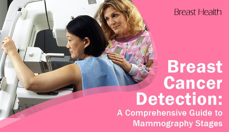 Breast Cancer Detection: A Comprehensive Guide to Mammography Stages