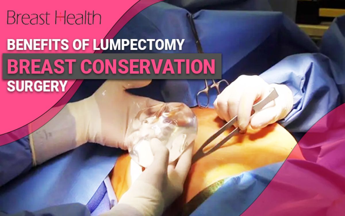 Benefits of Lumpectomy Breast Conservation Surgery