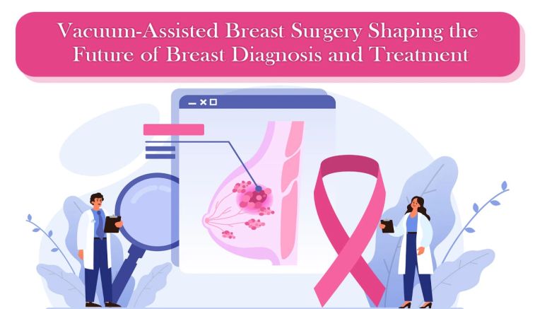 Vacuum-Assisted Breast Surgery Shaping the Future of Breast Diagnosis and Treatment