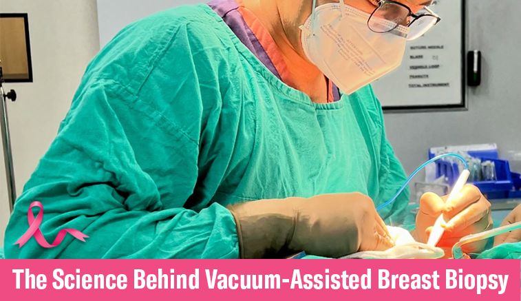 The Science Behind Vacuum-Assisted Breast Biopsy