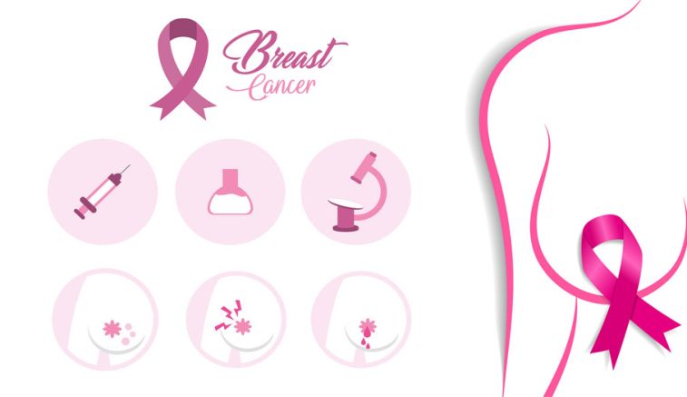 Get the best breast cancer treatment in Delhi