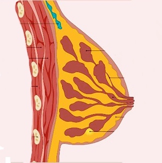 Phyllodes Tumour Treatment