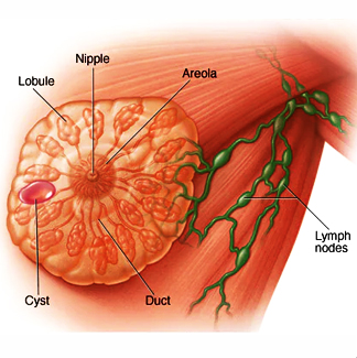 Breast Cyst Treatment