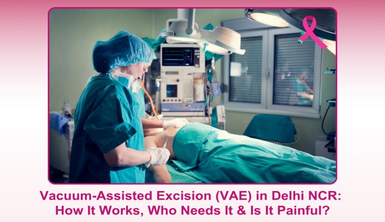 Vacuum-Assisted Excision (VAE) in Delhi NCR: How It Works, Who Needs It & Is It Painful?